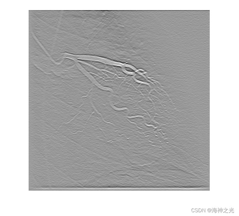 【图像增强】基于matlab Frangi滤波器血管图像增强【含Matlab源码 2108期】_matlab_06