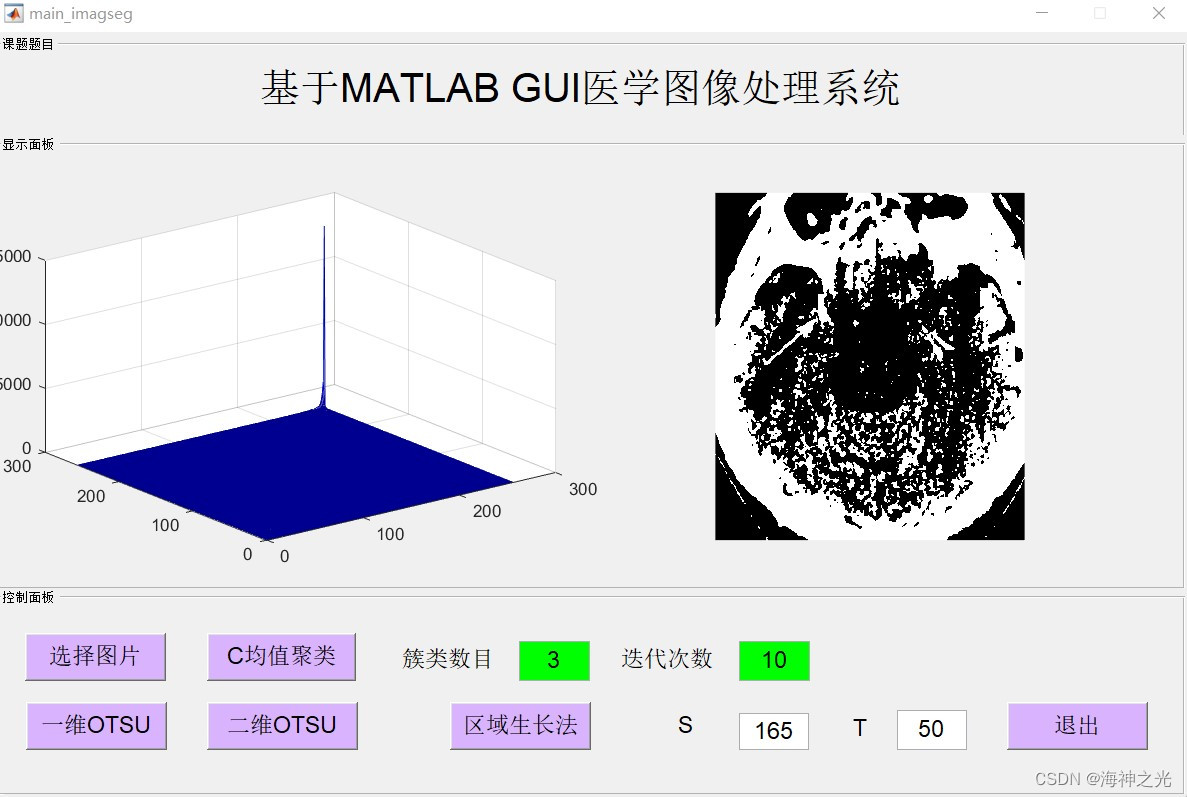 【图像分割】基于matlab GUI医学图像均值聚类+OUST+区域生长法图像分割【含Matlab源码 2210期】_边缘检测_11