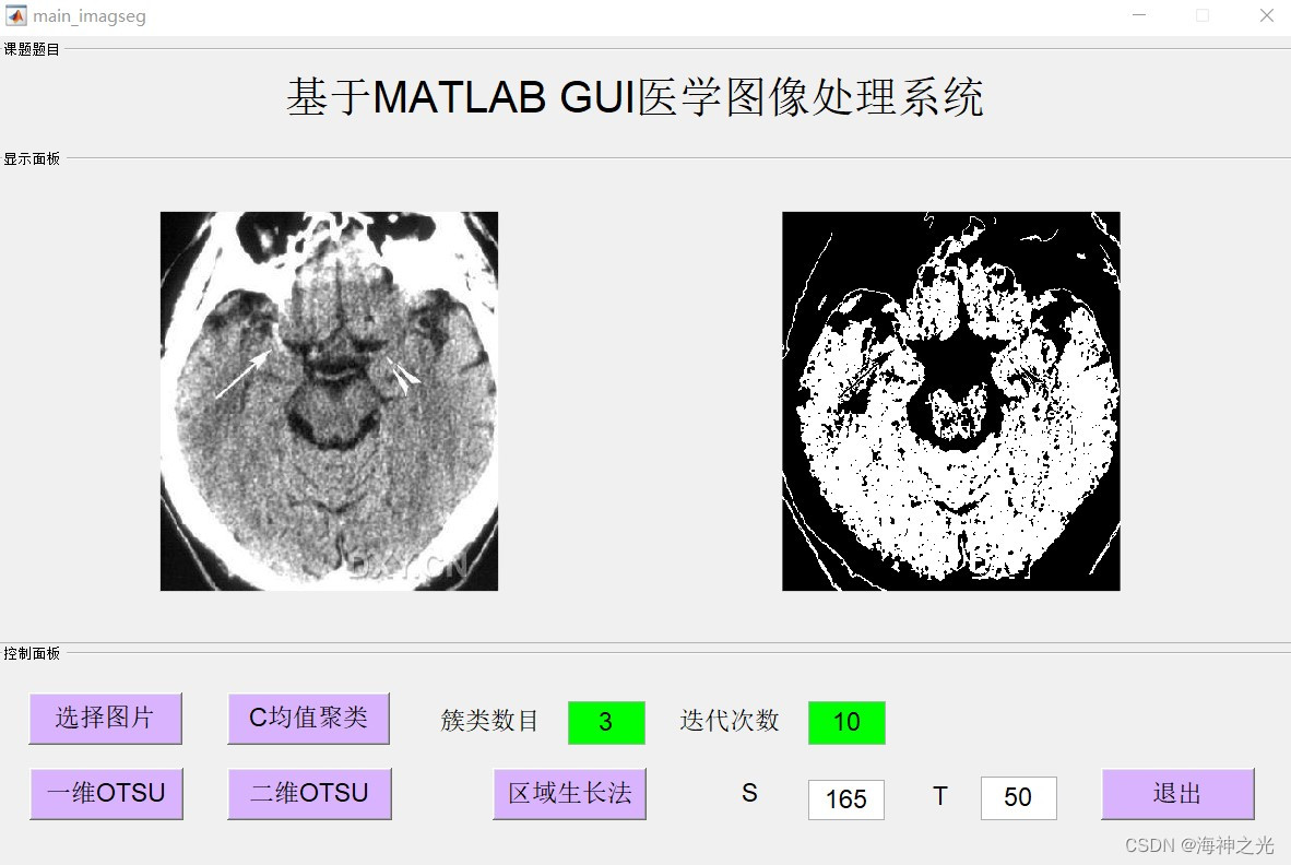 【图像分割】基于matlab GUI医学图像均值聚类+OUST+区域生长法图像分割【含Matlab源码 2210期】_边缘检测_12