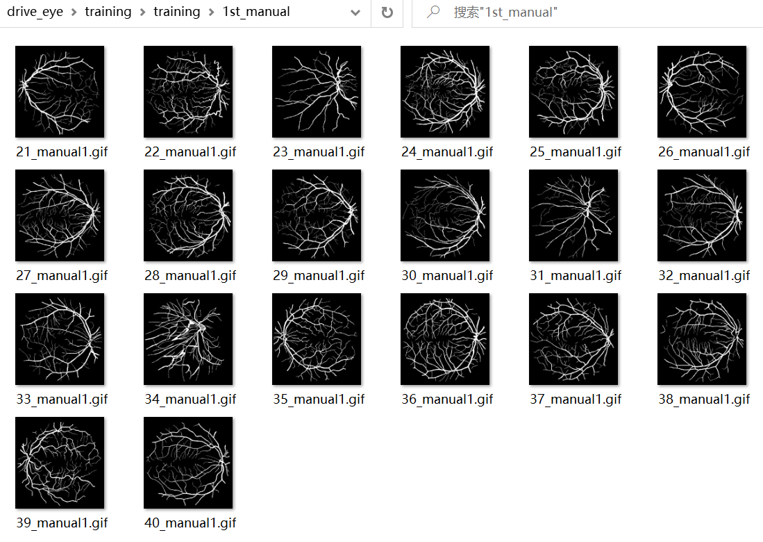基于PaddleSeg的眼底血管分割——使用飞桨助力医学影像分析_1024程序员节_02